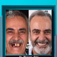ایمپلنت دندان پزشکی تعرفه دولتی دندانپزشکی تضمینی|خدمات آرایشگری و زیبایی|شیراز, معالی‌آباد|دیوار