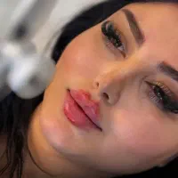 آموزش و انجام تمامی خدمات تزریق ژل،بوتاکس،آنزیم،نخ