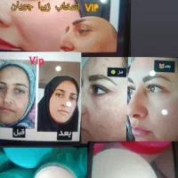 کرم قوی پوست