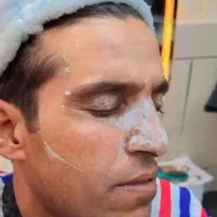 اکتیواتوفن پوست|آرایشی، بهداشتی، درمانی|سنندج, |دیوار