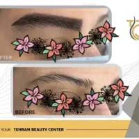 کاشت مو، کاشت ابرو، بلفارو، عمل بینی، رفع غبغب|خدمات آرایشگری و زیبایی|کرج, فاز ۱ مهرشهر|دیوار