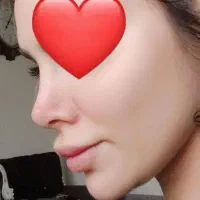 نوبت دهی آنلاین جهت زیبایی عمل بینی