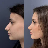 استخدام پرستارکلینیک زیبایی|استخدام درمانی، زیبایی، بهداشتی|تهران, قیطریه|دیوار