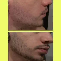 ریشه قوی تار قوی
