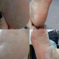 موخوره گیری کفسابی پارنگ لایت کراتین واموزش لاینها|خدمات آرایشگری و زیبایی|قم, زنبیل آباد|دیوار