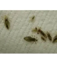 پاکسازی مو از شپش با دستگاه و محلول استرالیایی