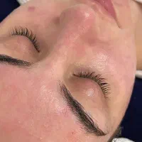 پاکسازی و فیشال پوست|خدمات آرایشگری و زیبایی|میبد, |دیوار