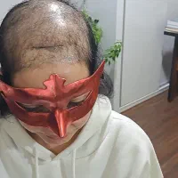 پروتز مو خانم احمدی|استخدام بازاریابی و فروش|رشت, گلسار|دیوار