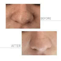 فیشال تخصصی۴۹۹/۰۰۰+ماساژ تخصصی رایگان(فقط۳نفر)