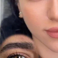 اتوپلاستی گوش / ساکشن غبغب/ بلفاروپلاستی|خدمات زیبایی و سلامت|تهران, نظامی گنجوی (توانیر)|دیوار