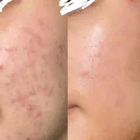 لاغری و پوست زیبا تضمینی
