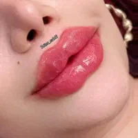 آفر ویژه آموزش حرفه ای فیلر و بوتاکس تا آخر هفته|خدمات آموزشی|تهران, هفت حوض|دیوار