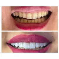 دندان پزشکی.بهترین و ارزانترین