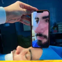 جراحی بینی فقط ۲۸ تومن( تضمینی) پیکرتراشی
