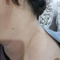 برداشتن خال زگیل و میخچه با محلول صدر صد گیاهی|آرایشی، بهداشتی، درمانی|کرمان, |دیوار