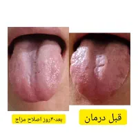 مشاوره رایگان