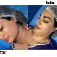 مرکز تخصصی پیکرتراشی و لیپو تهرانپارس|خدمات آرایشگری و زیبایی|تهران, تهرانپارس شرقی|دیوار