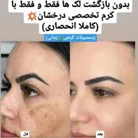 (کرم ضدلک و روشن کننده درخشان)بدون بازگشت|آرایشی، بهداشتی، درمانی|شیراز, قصرالدشت|دیوار