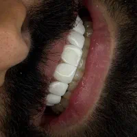 با اعتماد به نفس لبخند بزن