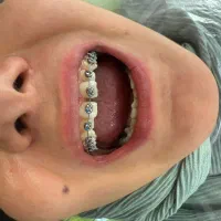 جشنواره زمستانه کلینیک دندانپزشکی سیب (نیمه دولتی)