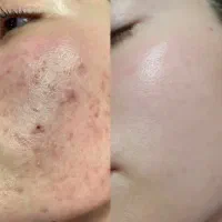 رهایی از مشکلات پوستت