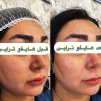 جشنواره هایفو به مناسبت روز مادر و افتتاحیه