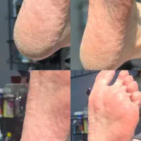 آموزش و‌خدمات پدیکور،اسپا و کفسابی درمانی و ریلکسی|خدمات آرایشگری و زیبایی|کرج, گلشهر|دیوار