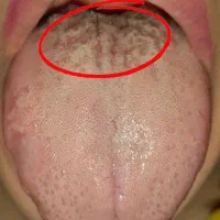 روغن های معجزه گر گیاهی