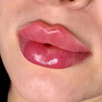 فیلر لب روسی عروسکی