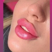 فیلر ژل لب تخصصی بوتاکس پزشک کلینیک زیبایی|خدمات آرایشگری و زیبایی|تهران, تهرانسر مرکزی|دیوار