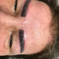 فیبروز ابرو