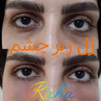 ژل/بوتاکس/آنزیم/مزو فقط ۳۰۰|خدمات آرایشگری و زیبایی|کرج, گوهردشت|دیوار