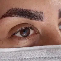 آموزش حرفه ای فیبروز خط چشم