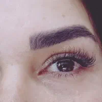 کاشت مژه هیدن