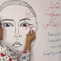اموزش فیلر بوتاکس مزو پی ار پی هایفو