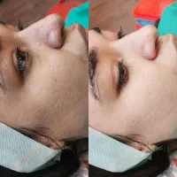 فشیال تخصصی