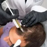 پی آر پی حجامت بادکش گرم فصد خون زالو مزاج شناسی