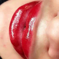 میکرو،فیبروز،تتو تضمینی ۱۰۰٪