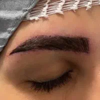 کاشت ابرو و مو ژل و بوتاکس با تخفیفات ویژه