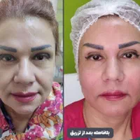 جشنواره ژل و بوتاکس و فیلر بادی(بدن)|خدمات آرایشگری و زیبایی|اصفهان, شهرک کاوه|دیوار