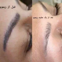 ریموو تتوهای قدیمی تک جلسه ای با آف ویژه|خدمات آرایشگری و زیبایی|شیراز, شهرک ولیعصر|دیوار