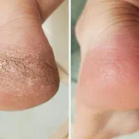 کفسابی/ پدیکور / + هدیه خفن|خدمات آرایشگری و زیبایی|اندیشه, اندیشه فاز ۱|دیوار