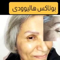بوتاکس طبیعی درهرسنی|خدمات آرایشگری و زیبایی|رشت, بلوار گیلان|دیوار