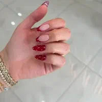خدمات تخفیف تکرار نشدنی همه مدل کاشت ۴۵۰ترمیم ۳۵۰