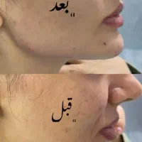 کلینیک زیبایی آذربایجان|خدمات آرایشگری و زیبایی|گرمی, |دیوار