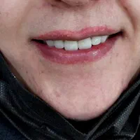 مرکز ساخت تخصصی دندان مصنوعی،دندانسازی باضمانت|خدمات آرایشگری و زیبایی|یزد, |دیوار