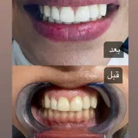 جشنواره تابستانه دندانپزشکی