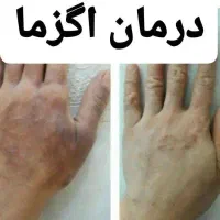 عدد بیماریت رو بگو ودرمان رو با کمک ما شروع کن|خدمات آرایشگری و زیبایی|بندرلنگه, |دیوار