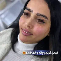 زیبایی ژل و بوتاکس|خدمات آرایشگری و زیبایی|اهواز, کیان اباد|دیوار
