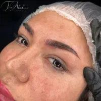 مدل فیبروز فقط با هزینه مواد